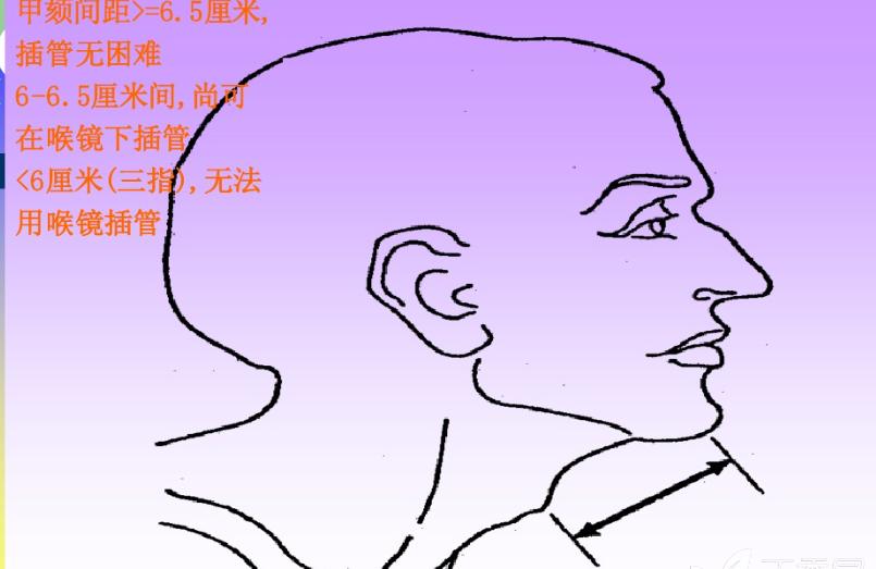 src-TVRZNMTY5NDUxMjkzMwaHR0cHM6Ly9pbWcxLmR4eWNkbi5jb20vMjAxNy8xMTE4LzcwMy8zMjQ0ODU0OTA4ODk0NjA5OTUwLTh3LnBuZw==.jpg