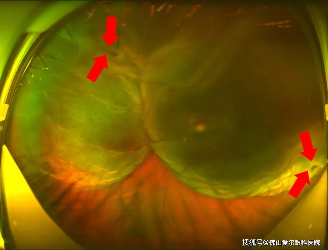 头疼表情包图片可爱_头疼表情包图片微信_头疼表情