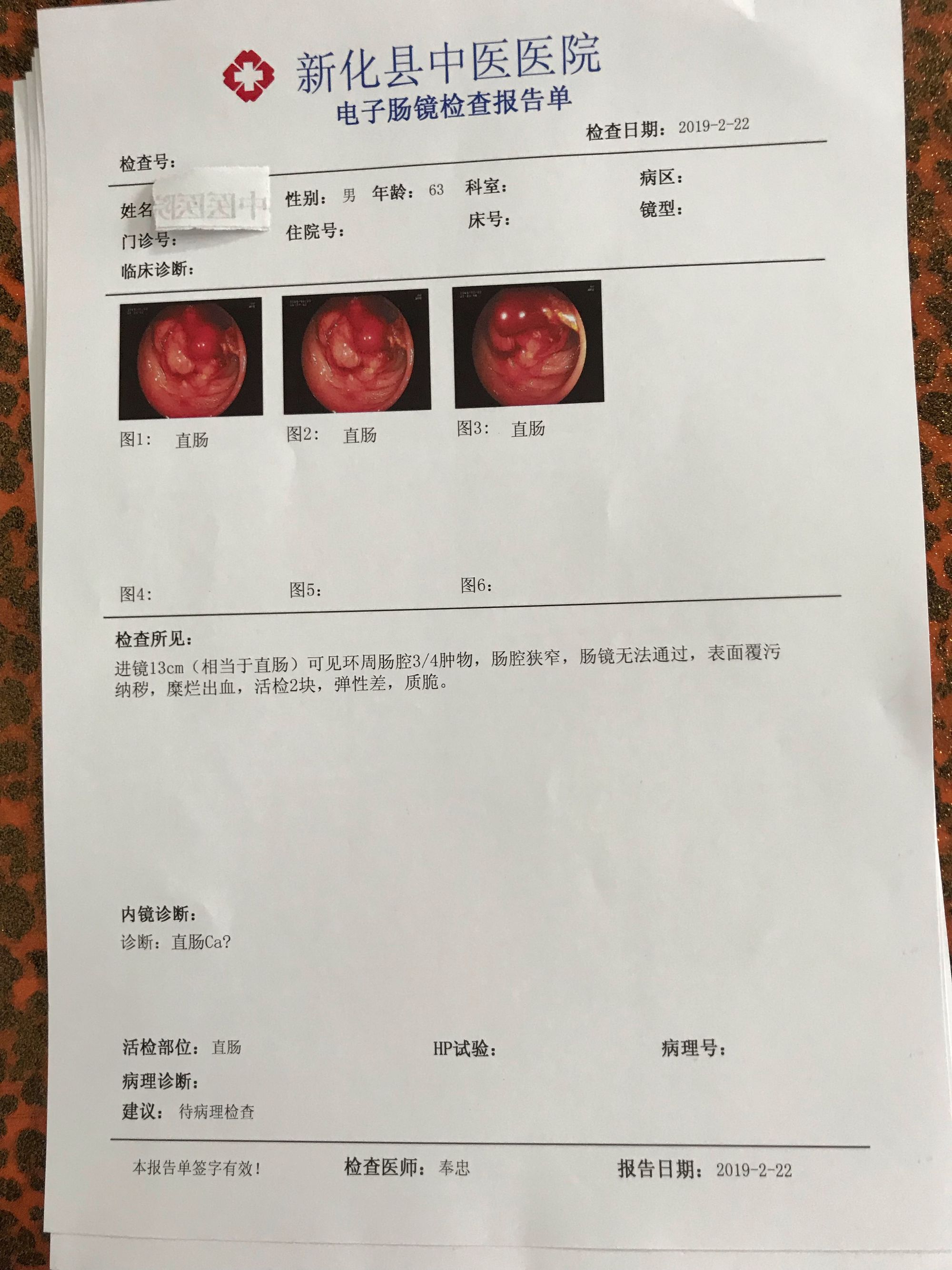 肛门坠胀大便失禁_肛门坠胀大便失禁_肛门坠胀大便失禁
