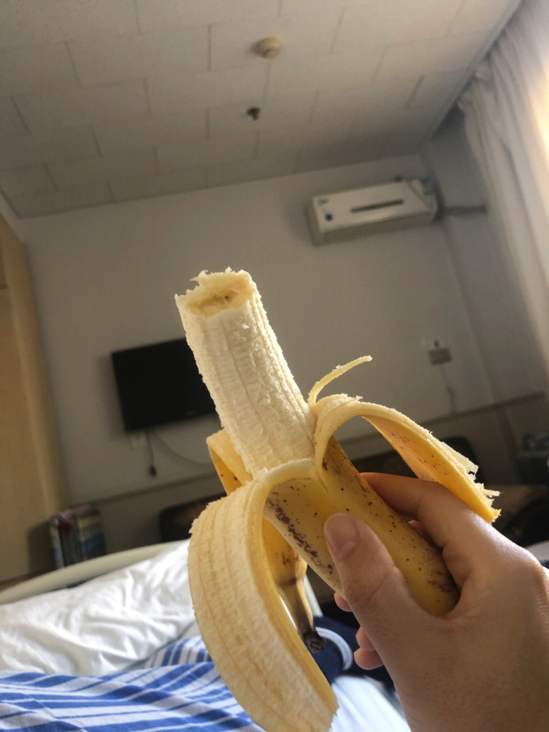肛瘘手术一般多长时间_多长手术一般肛瘘时间长啊_一般肛瘘手术需要几个小时