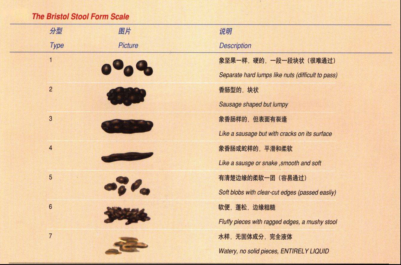 克罗恩病大便化验能检查出来吗_克罗恩病的大便图片_克罗恩大便形状