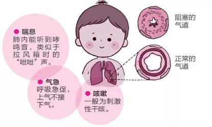 哮喘突然发作是什么原因_突然哮喘是怎么回事_哮喘突然发作怎么办