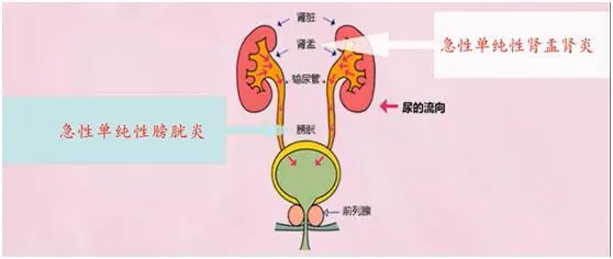北京佑安医院泌尿科_北京医科大附属佑安医院_佑安医院泌尿外科