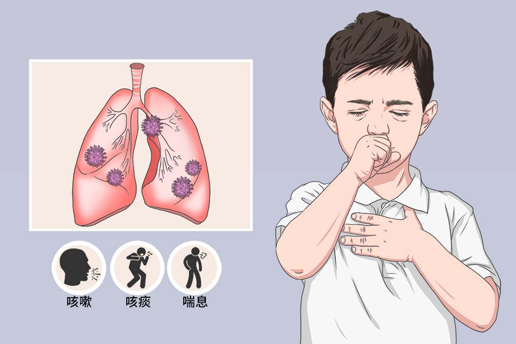 小儿肺炎用甲强龙副作用大吗_甲强龙治疗儿童肺炎_小儿肺炎用甲强激素的危害