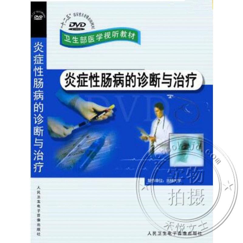 克罗恩的中医疗法_克罗恩病/中西医结合疗法_治疗克罗恩病中医好还是西医好
