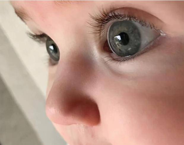 婴儿的眼睛白眼球是蓝色的_婴儿白眼珠子发蓝_婴儿眼睛白眼球发蓝