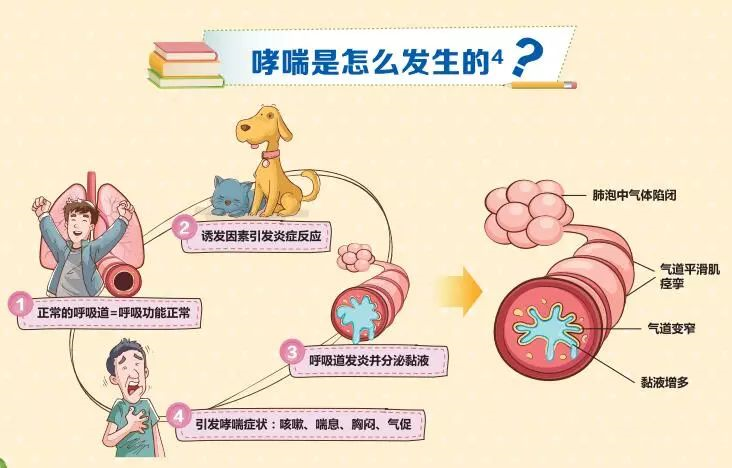 早期哮喘怎么办_早期哮喘有什么症状_哮喘早期得到了规范治疗还会范吗
