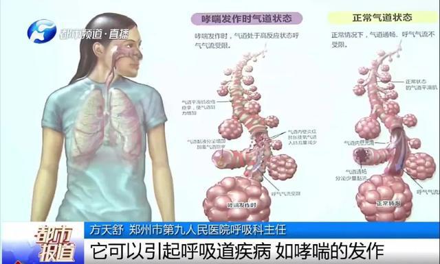 哮喘早期得到了规范治疗还会范吗_早期哮喘怎么办_早期哮喘有什么症状