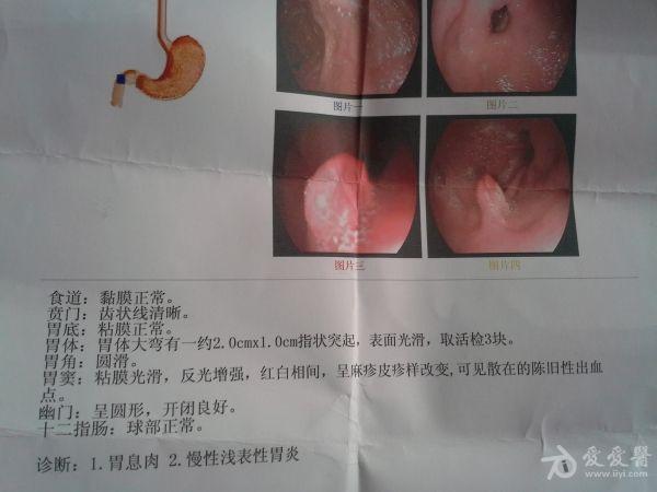 化龙巷论坛胃病_胃病病友论坛_全国胃病论坛网