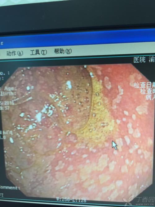 化龙巷论坛胃病_胃病病友论坛_全国胃病论坛网