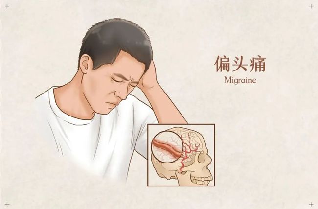头疼医头_头疼医头脚痛医脚的哲学原理_头疼医头脚疼医脚是什么观点