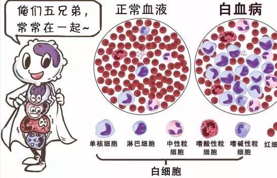 白血病晚期能看好吗_白血病晚期能活多久_白血病晚期能不能治疗