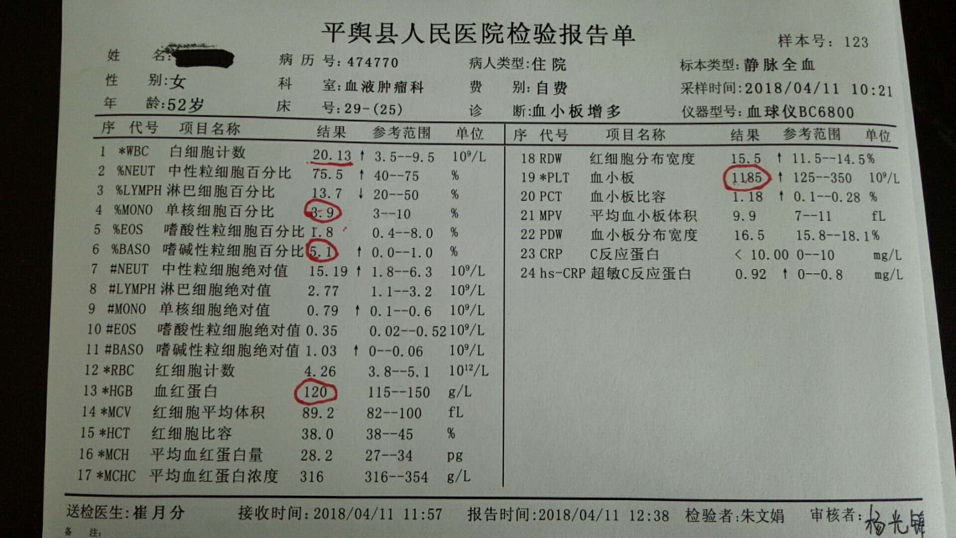 晚期白血病可以治愈吗_白血病晚期能活多久_晚期白血病能活多久呢