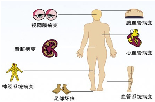 罗克罗恩病_罗克罗恩病的特征性体征_克罗恩并发症