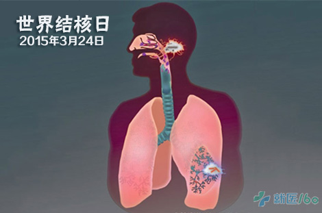 浸润型肺结核会复发吗_肺浸润结核型复发会癌变吗_浸润性肺结核复发率