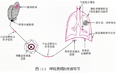 呼吸衰竭定义是指_二型呼吸衰竭定义_呼吸衰竭的定义和分型是什么