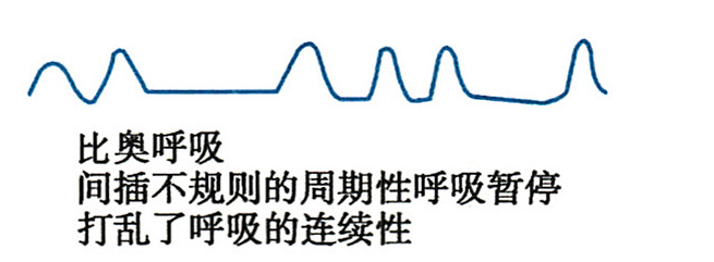 小孩儿哮喘视频播放什么症状_小儿哮喘症状模拟视频_哮喘情景模拟