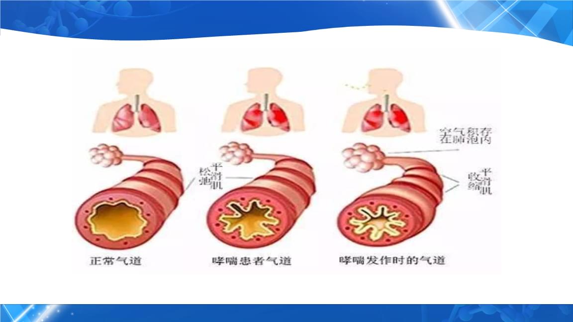 哮喘情景模拟_小孩儿哮喘视频播放什么症状_小儿哮喘症状模拟视频