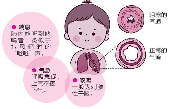 田亮有哮喘吗_田亮有哮喘吗_田亮有哮喘吗