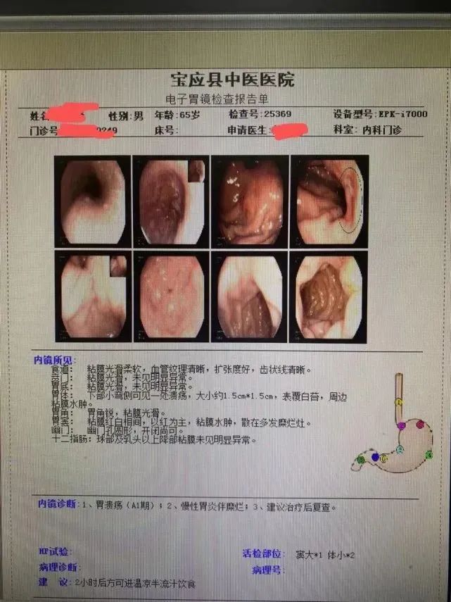 西安看胃病的专科医院_西安看胃病哪家医院看好_西安胃病看得好的医院