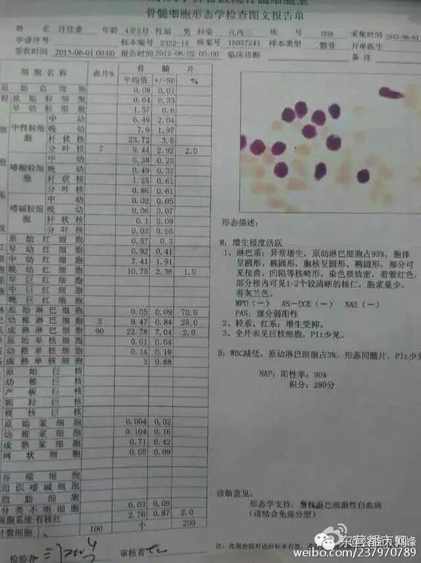 急性白血病活不过3个月_急性白血病接受治疗能活多久_急性白血病成活率