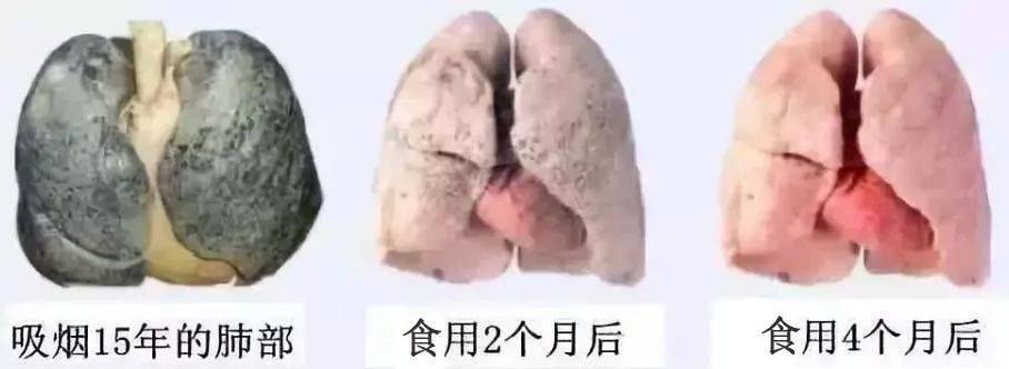 肺里白痰粘稠_肺里白痰多是怎么回事_肺里白痰