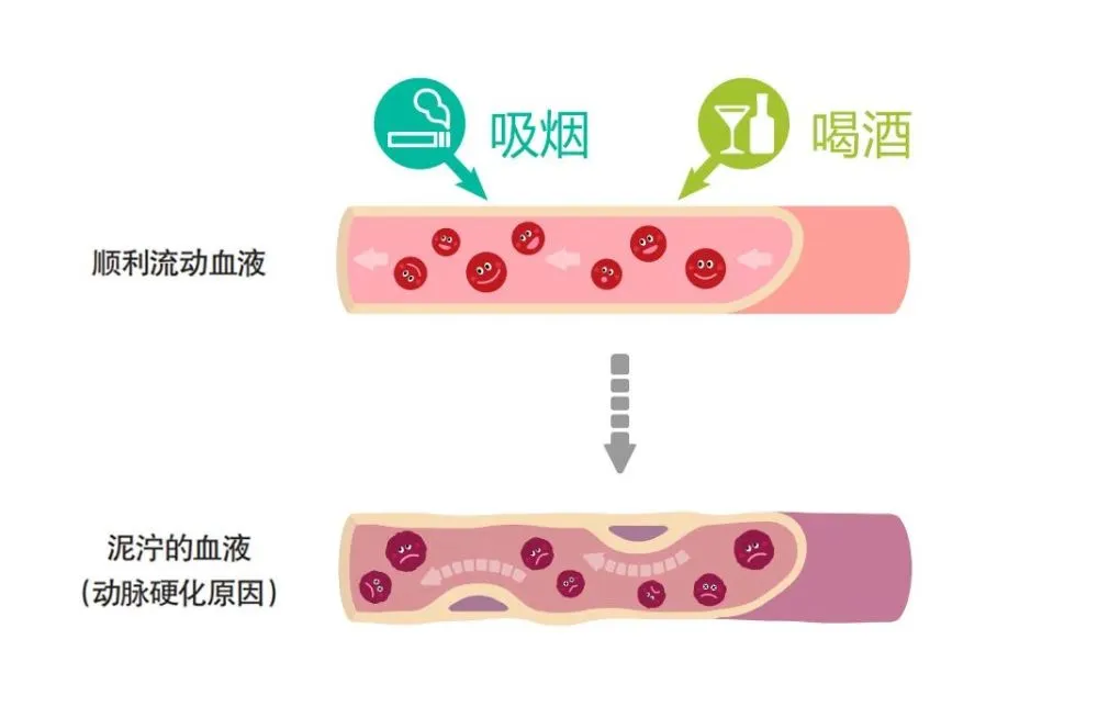 冠心病得预防治疗方法_预防冠心病的有效方法_预防冠心病用什么药好