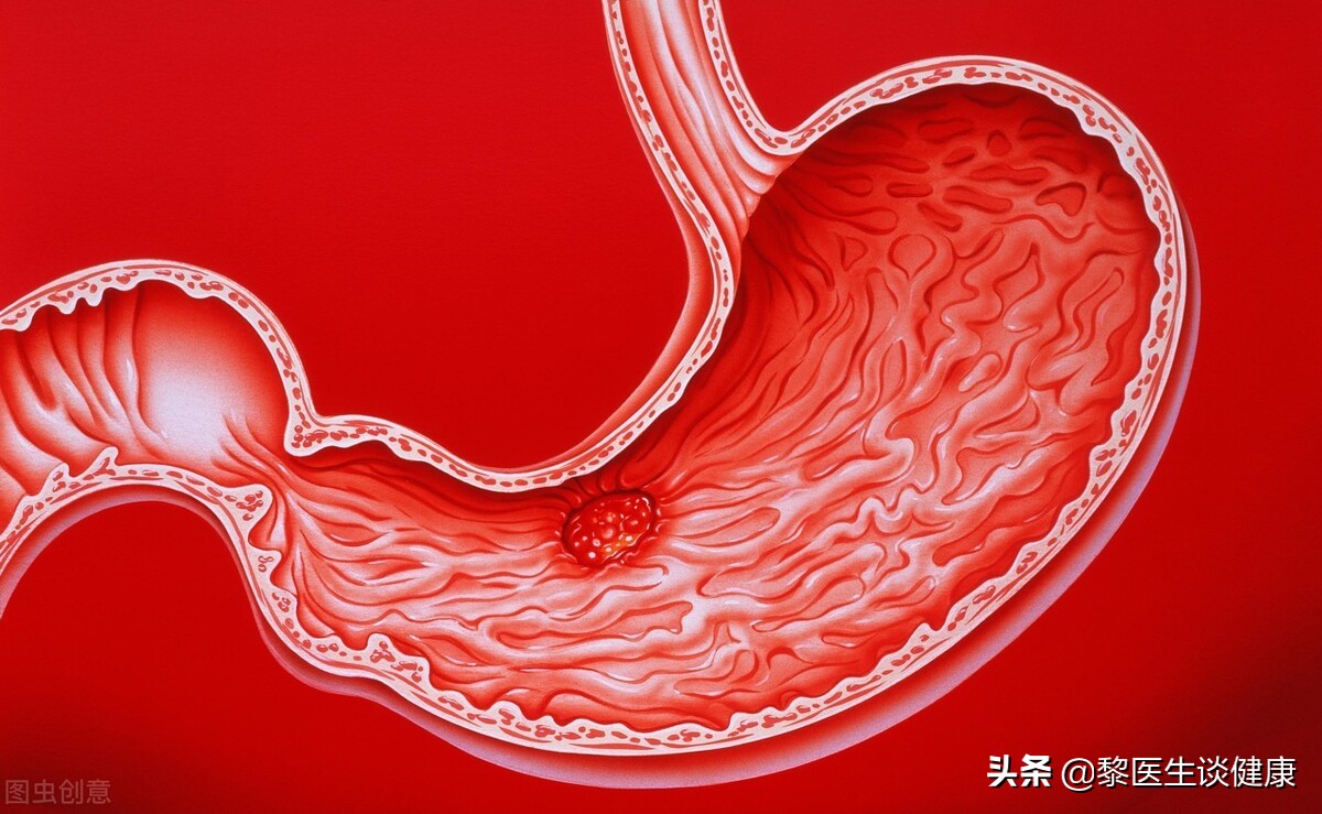 西安最擅长治胃病的医生是谁_西安治胃病医院_西安胃病论坛