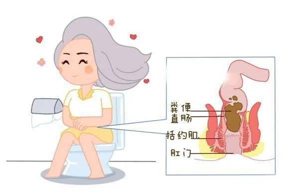 肛门闭锁大便失禁