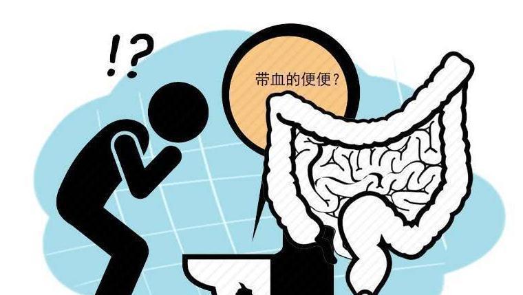 我每天大便出血是怎么回事_出血每天大便回事是怎么回事_每天大便流血