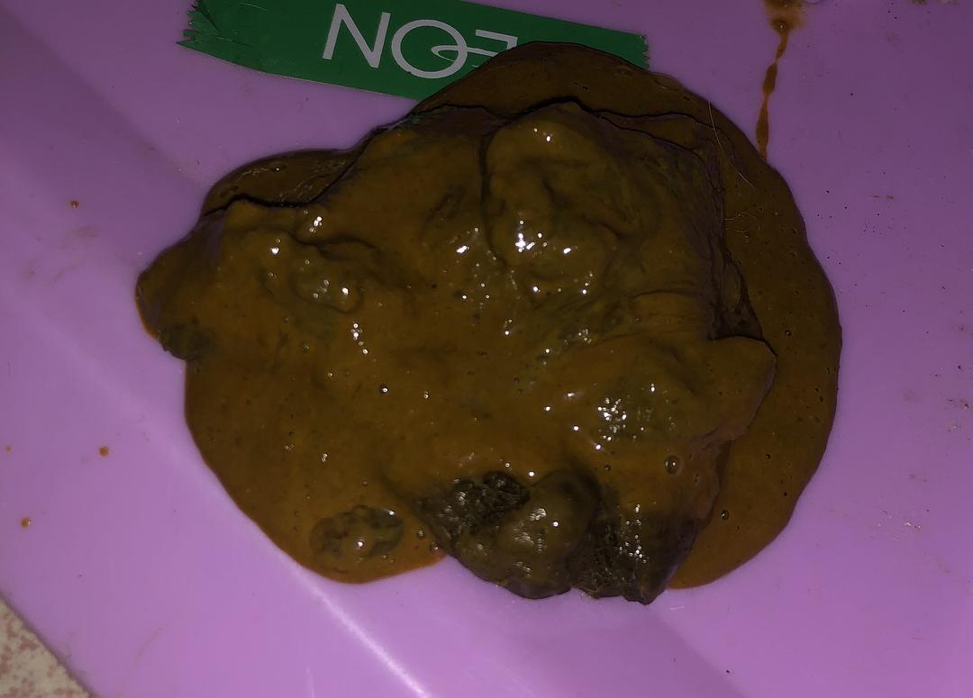 便秘大便出血是怎么回事_出血便秘大便回事是什么原因_便血还便秘