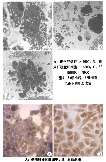 肺细胞角蛋白_肺细胞角蛋白高可能是什么病_肺细胞角蛋白高8点多危险吗