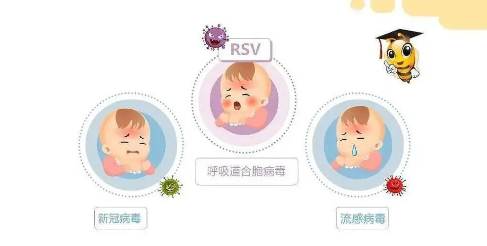 呼吸道合胞病毒性肺炎治疗原则_呼吸道合胞病毒(rsv)肺炎_呼吸合胞病毒性肺炎