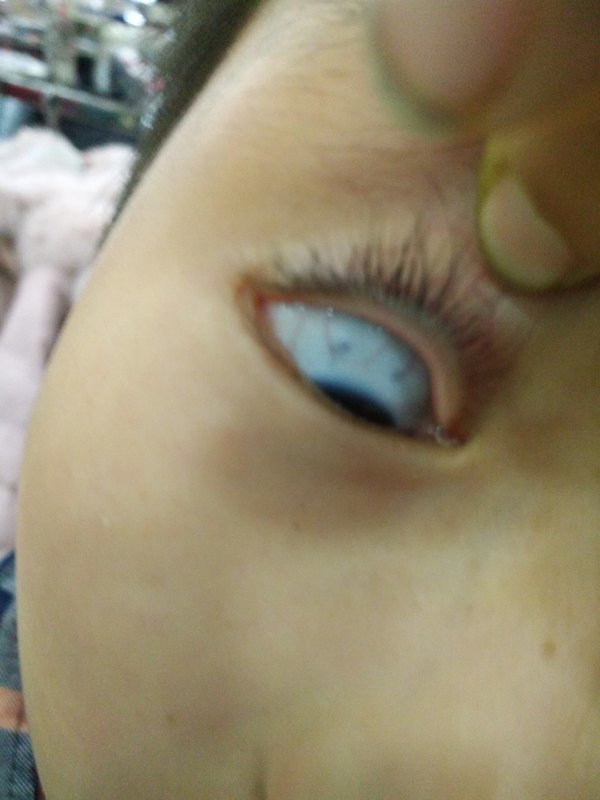 孩子的白眼珠发蓝_孩子白眼珠发蓝色_小孩白眼球发蓝