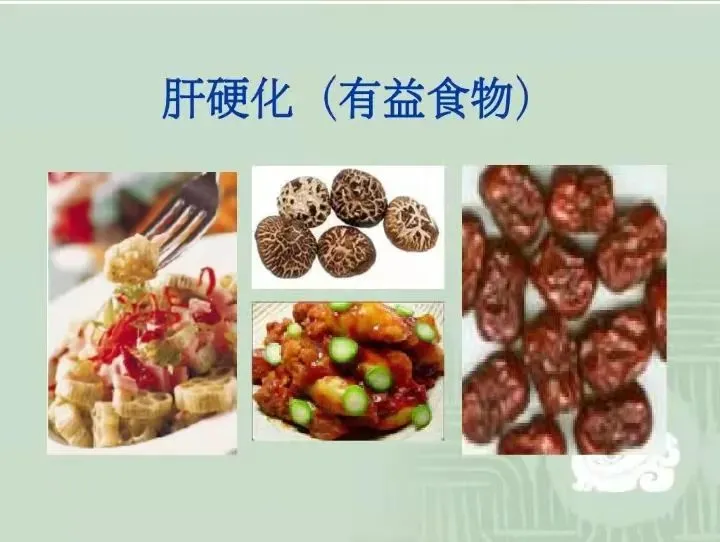 肝腹水饮食注意事项_肝腹水如何注意饮食_肝腹水注意哪些事项