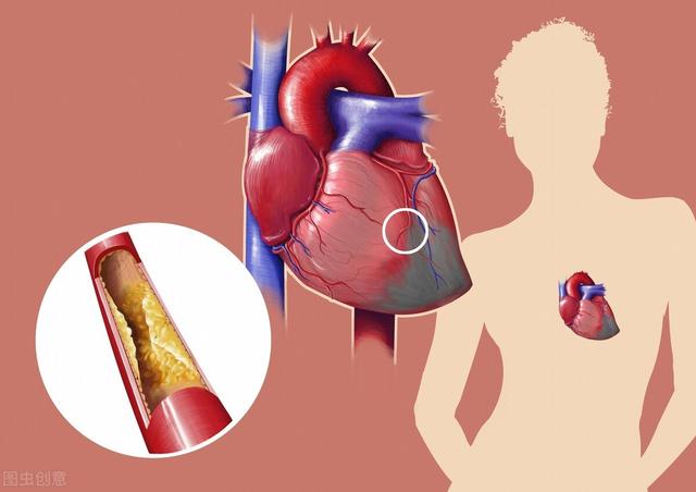 危险冠心病因素不包括_冠心病危险因素_冠心病危险因素是