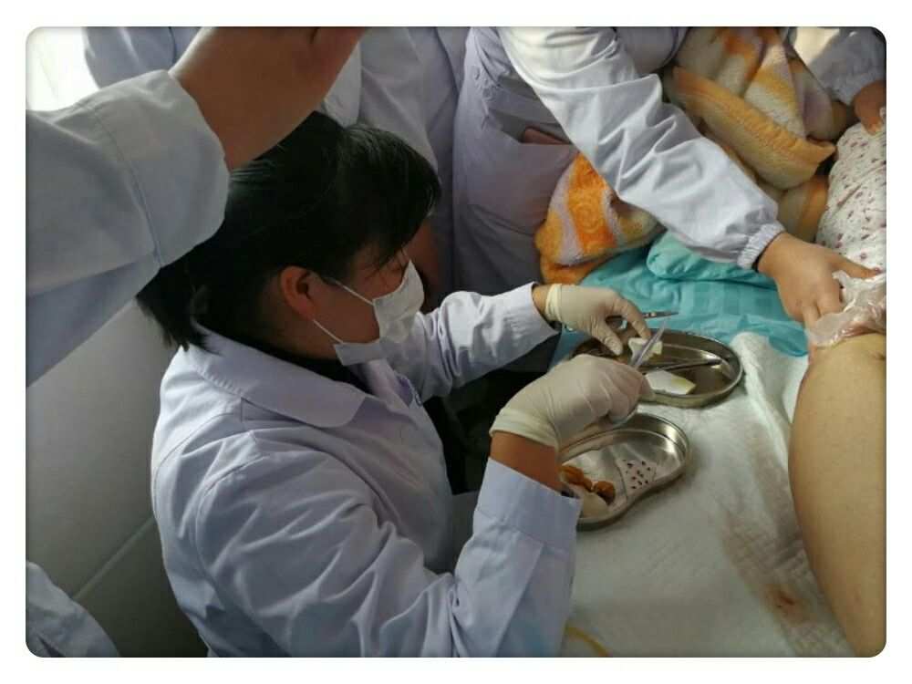 肛瘘手术后换药多久拿掉纱布_肛瘘手术后换药要多长时间_肛瘘手术换药多久