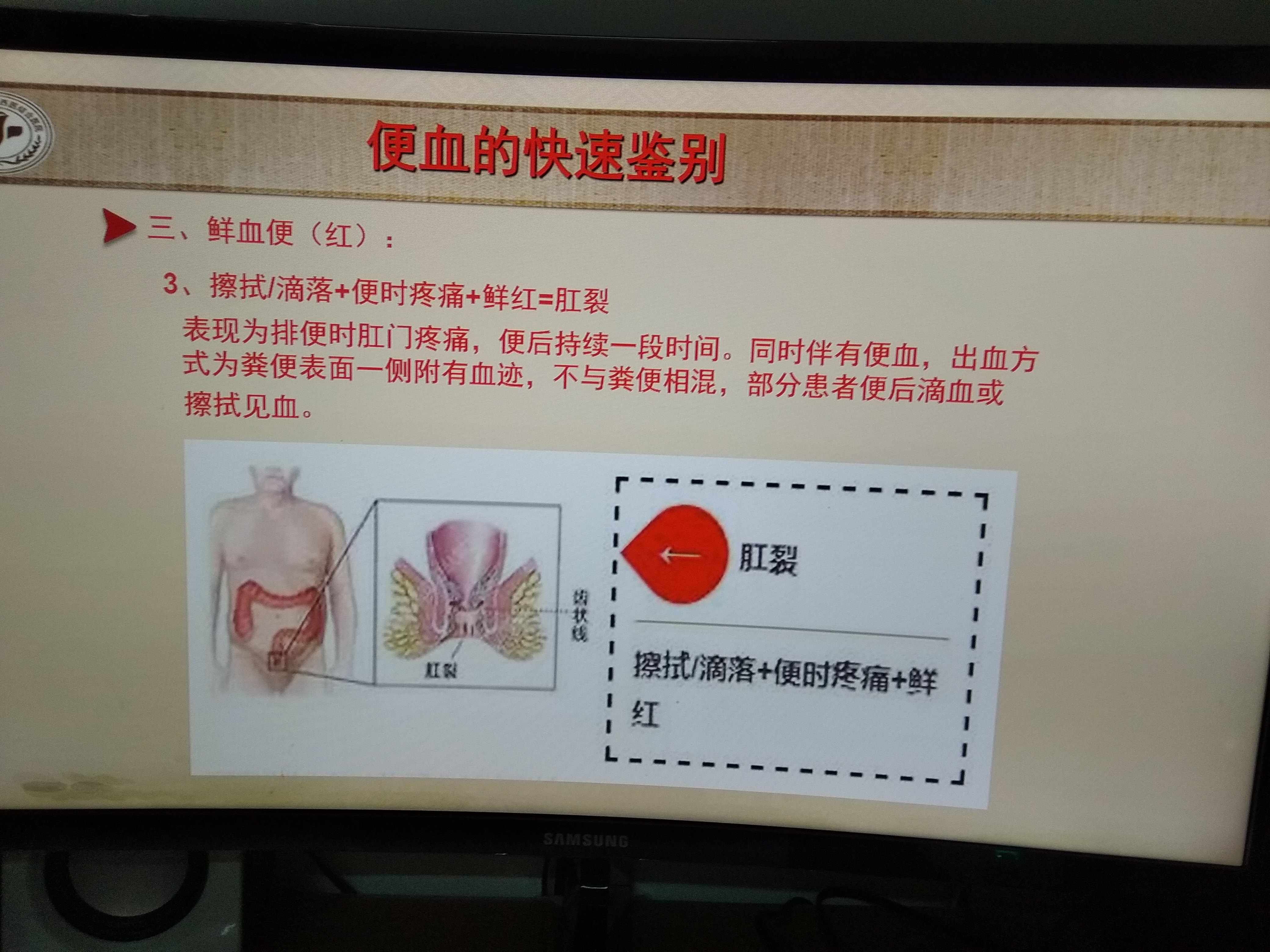 鲜血大便结拉肠炎性出血怎么办_溃疡性结肠炎大便拉出很多鲜血_大便出血结肠炎