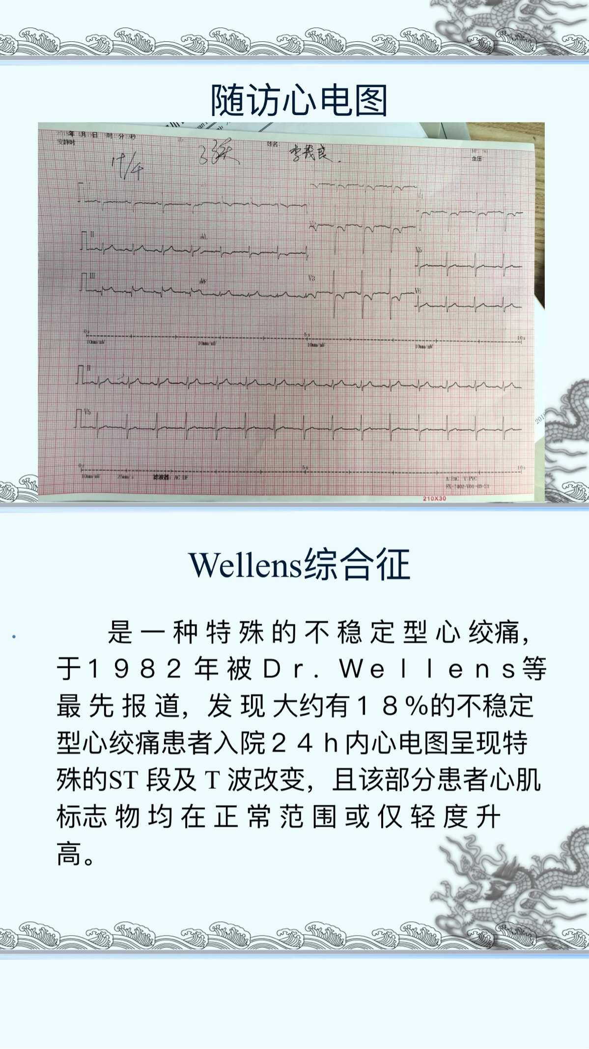 冠心病诊断_诊断冠心病最可靠的方法是_诊断冠心病最有价值的检查是