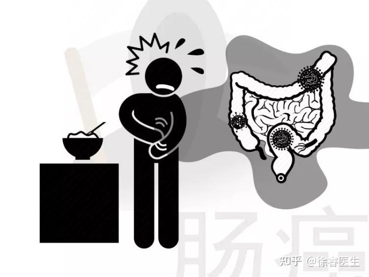 肛门半失禁_肛门半失禁_肛门半失禁