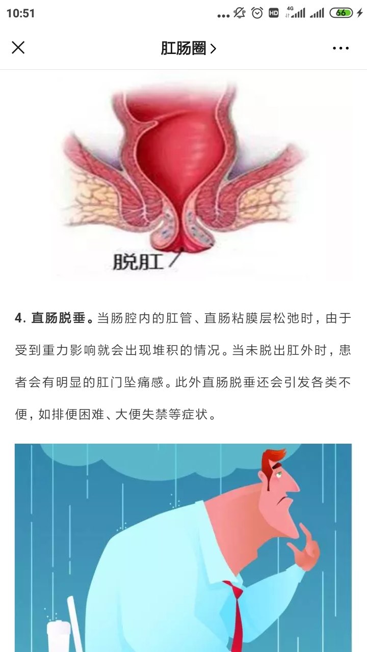 肛门坠胀大便后加重_大便肛门坠胀痛_肛门坠胀大便失禁