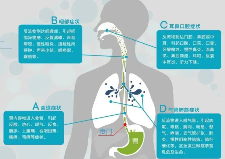 吃过奶打嗝_吃好奶打嗝_吃过奶打嗝是饱嗝吗