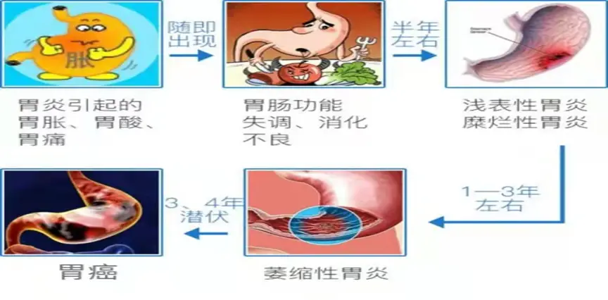 胃病健康知识讲座_关于胃病的讲座_讲座胃病知识健康教育内容