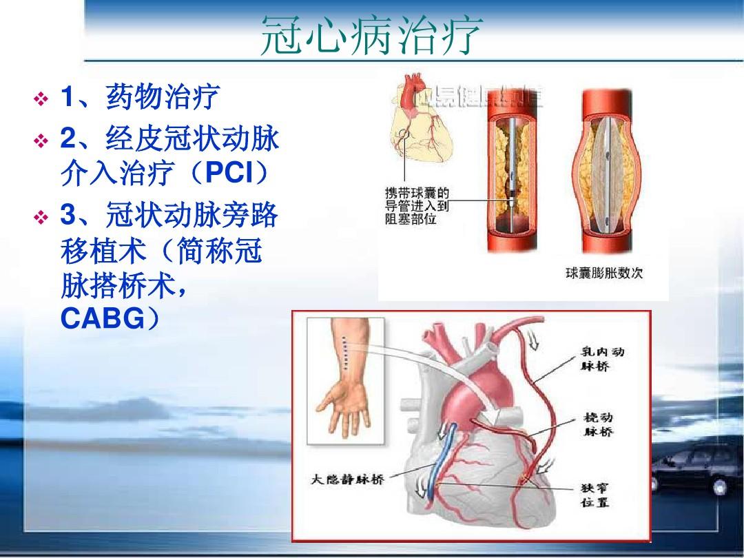 冠心病患者疑难病例讨论_病例冠心病疑难讨论范文_冠心病疑难病例讨论