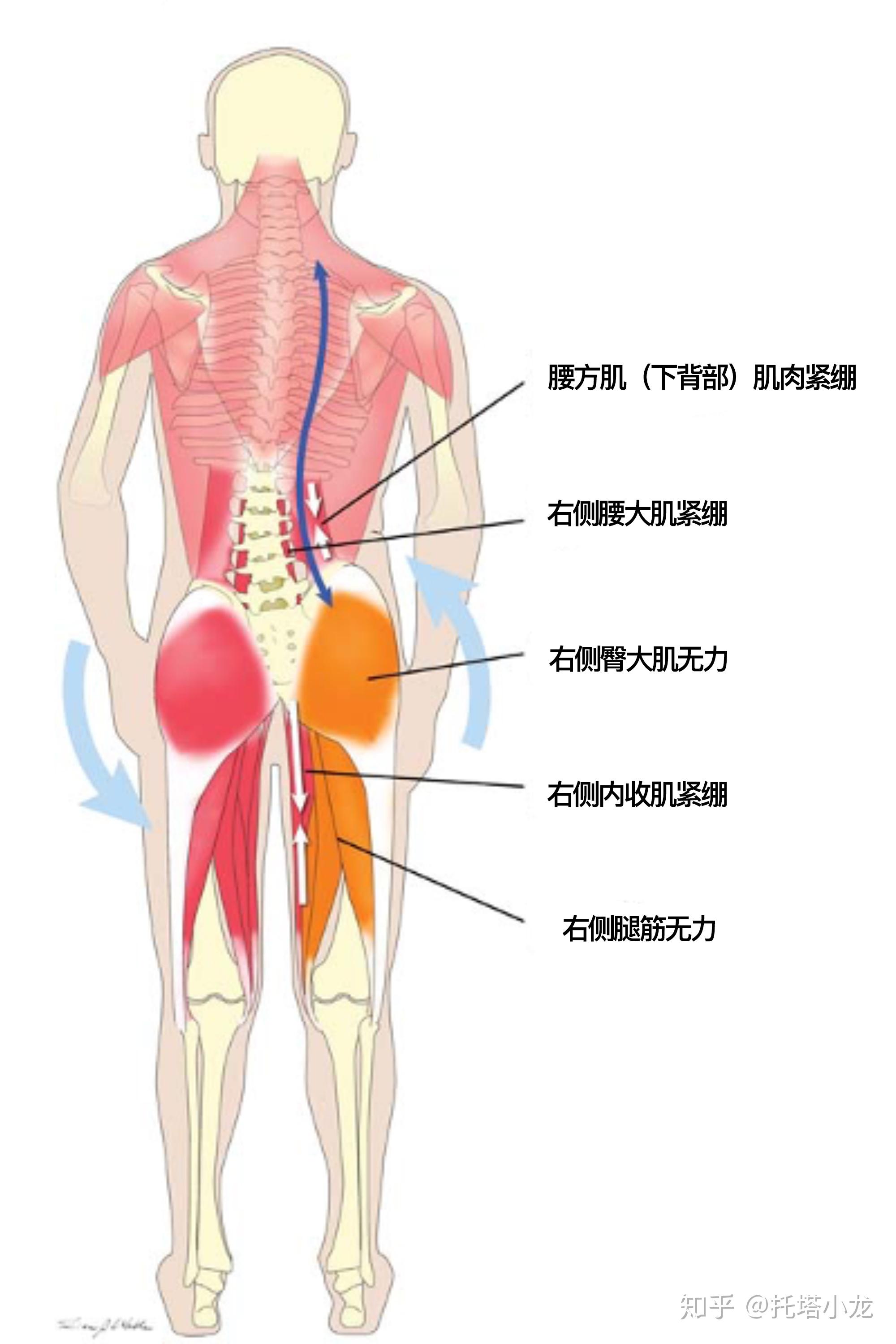 背痛吸气痛_吸气时背部疼痛的原因_背疼吸气就疼怎么回事