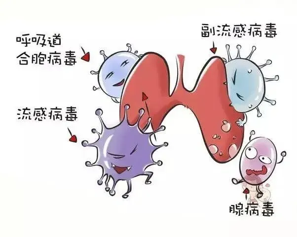 肺部感染白痰_肺感染白痰_白痰肺炎