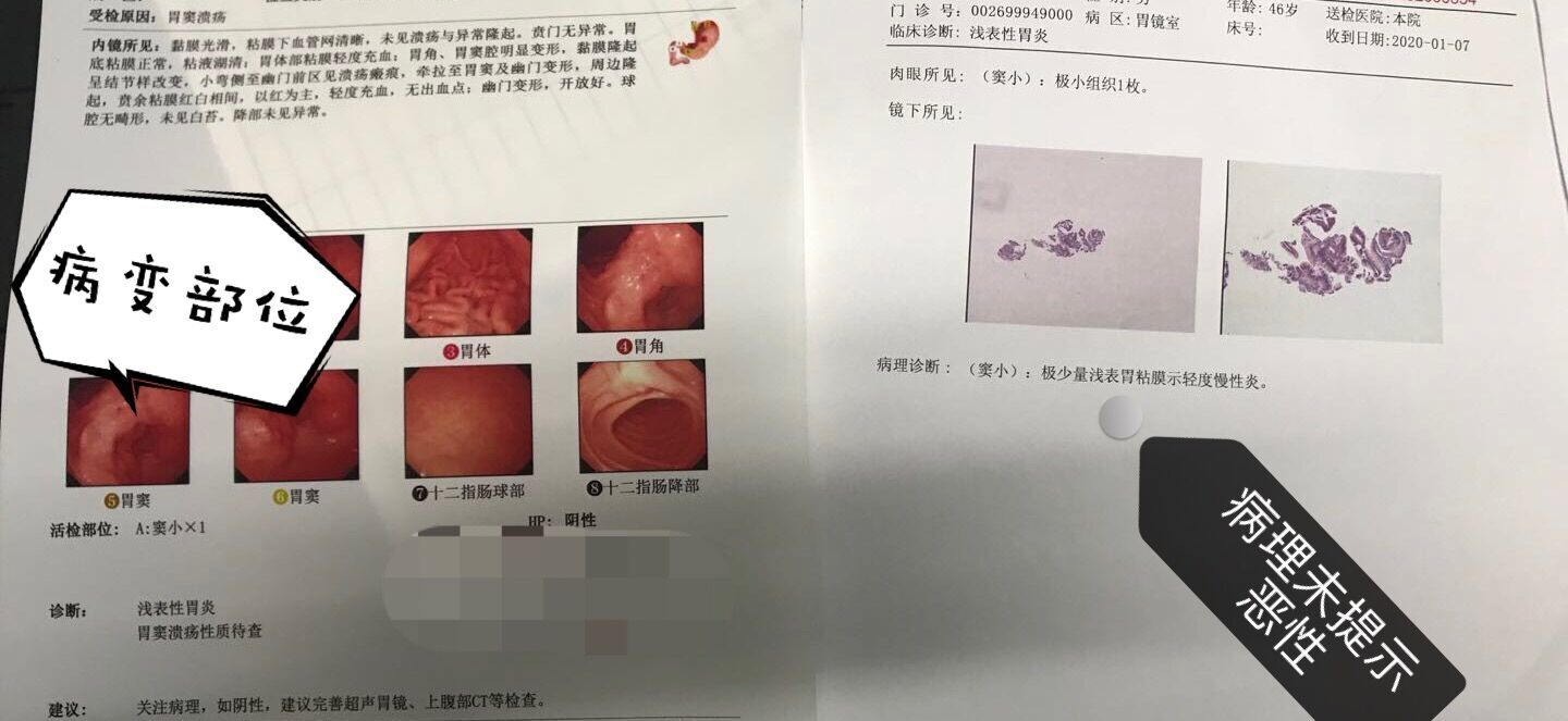 中里巴人论坛胃病_中里巴人调理胃_中里巴人治疗胃不舒服
