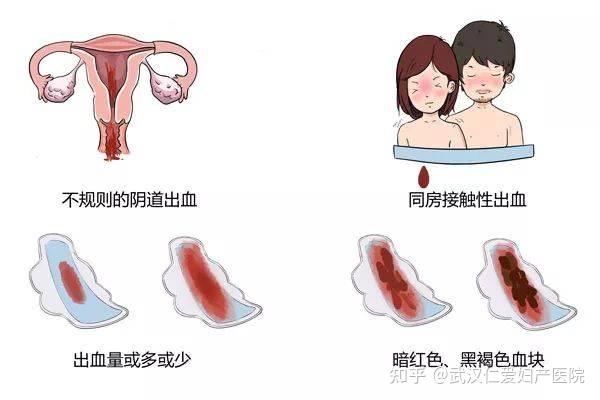 血液疾病症状_血液症状疾病都有哪些_血液症状疾病有哪些