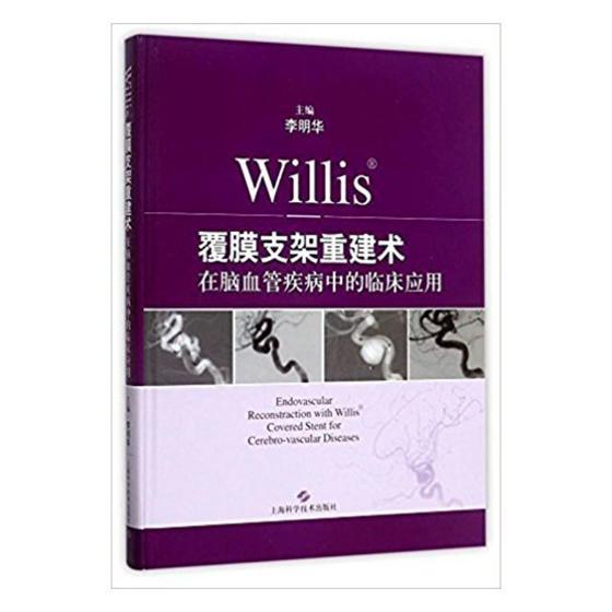 心肌梗塞介入手术并发症_心梗介入治疗并发症_心肌梗死介入后的并发症