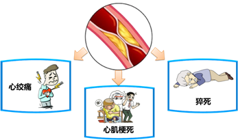 冠心病评估诊断实施评价_样本评估护理冠心病表格怎么写_冠心病护理评估表样本